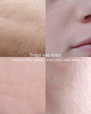 Trápí vás viditelné linky, šupinky, pnutí nebo mdlá barva pleti? 😟 ⠀ Tohle jsou typické projevy dehydratace – a můžou se...